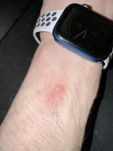 Apple Watch Series 12 and Ultra 4 Users Report Skin Irritation: Analyzing the Causes and Solutions